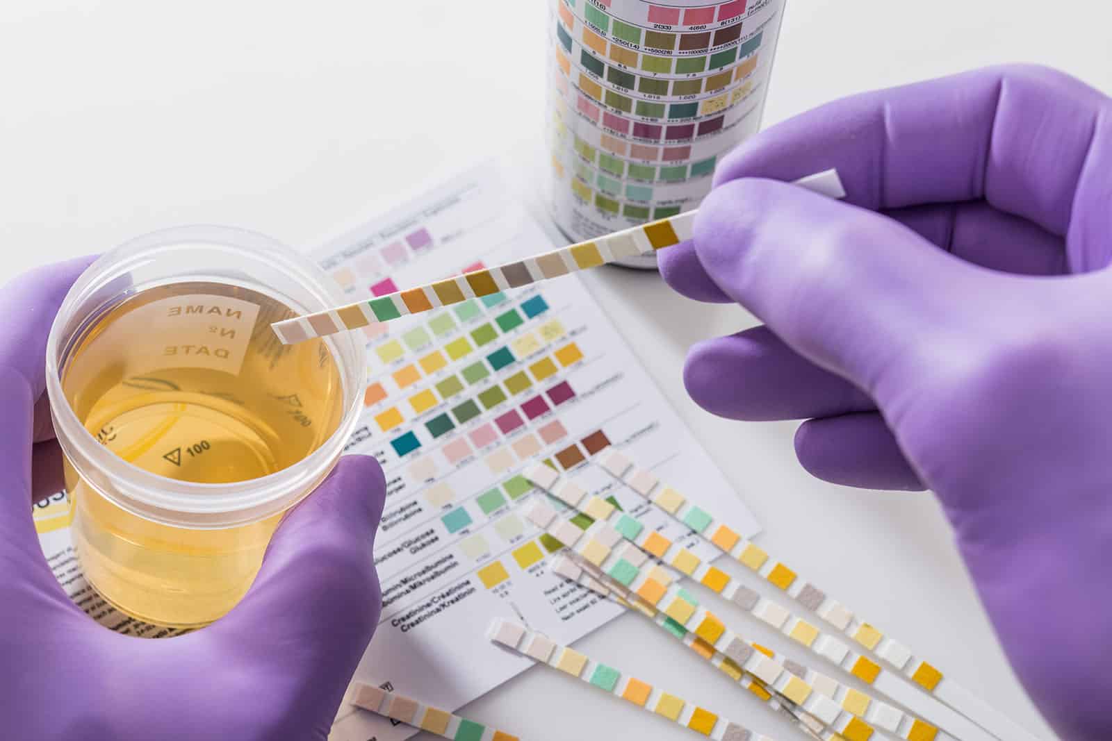 Urine Test