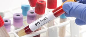 STD