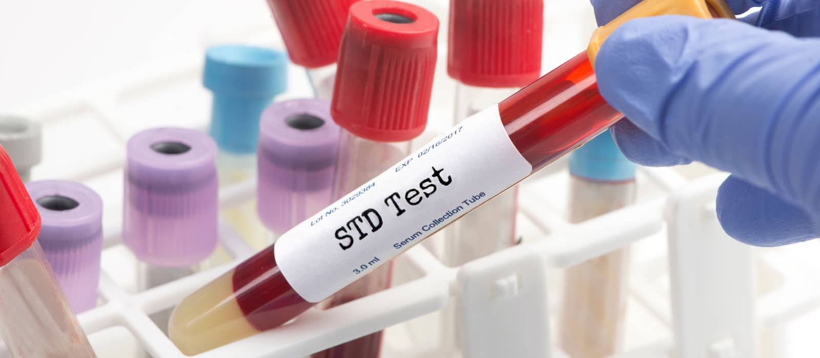 Do Normal Blood Tests Show STDs?