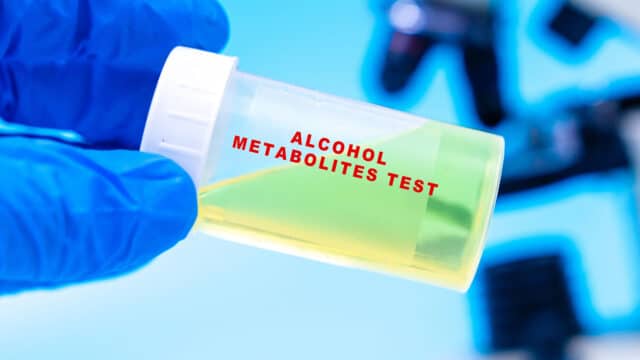 alcohol metabolites test