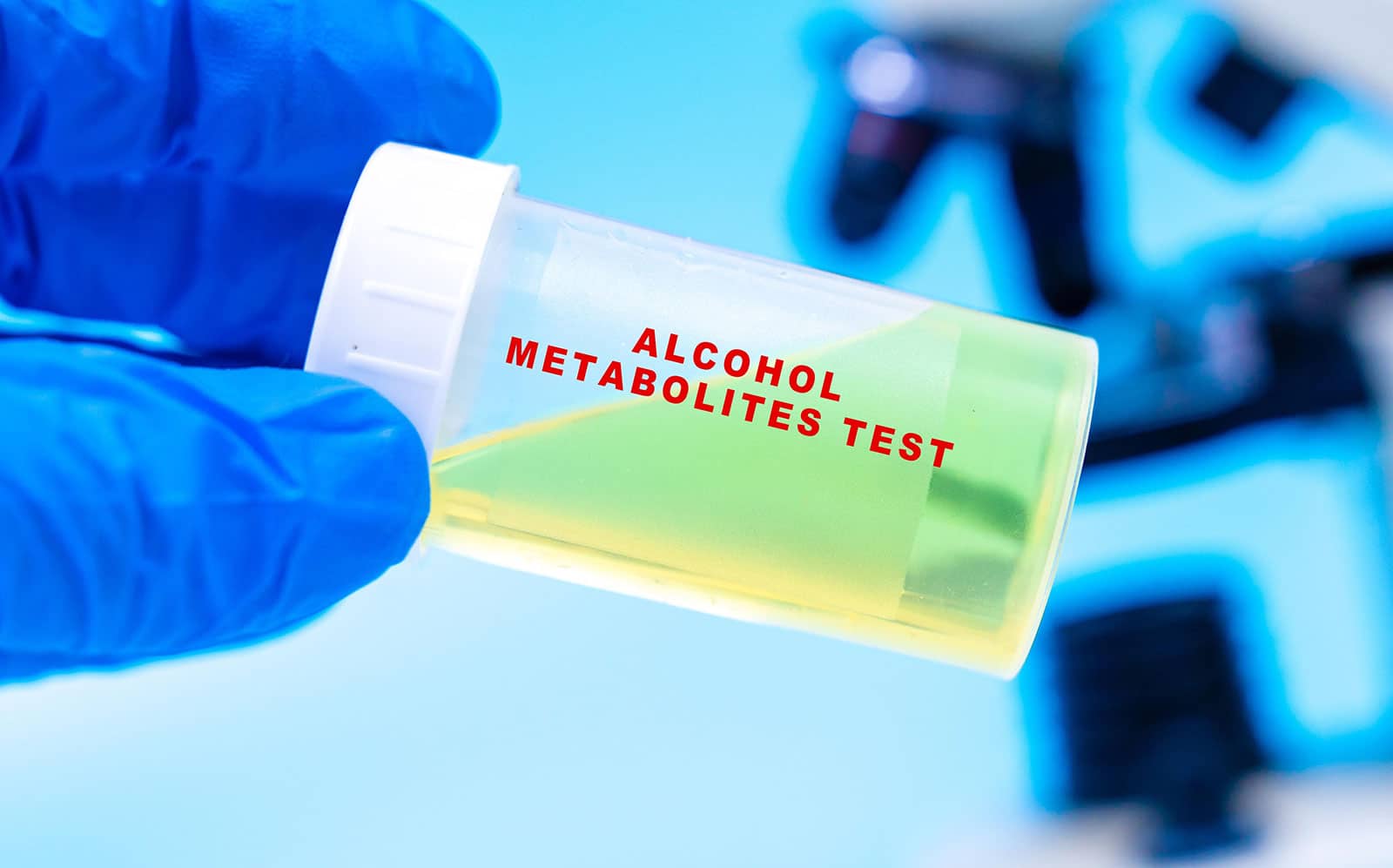 alcohol metabolites test